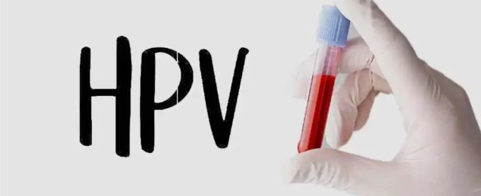 HPV Typing